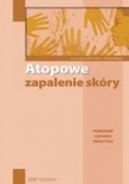 Okadka - Atopowe zapalenie skry. Poradnik lekarza praktyka