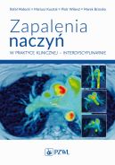 Okadka - Zapalenia naczy  w praktyce klinicznej interdyscyplinarnie. Diagnostyka i leczenie