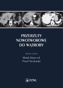 Okadka - Przerzuty nowotworowe do wtroby