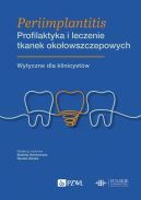 Okadka - Periimplantitis. Profilaktyka i leczenie tkanek okoowszczepowych