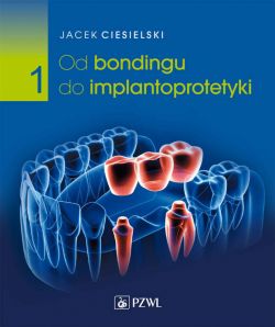 Okadka ksiki - Od bondingu do implantoprotetyki. Cz. I