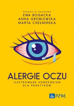 Okadka ksiki - Alergie oczu. Ilustrowane kompendium dla praktykw