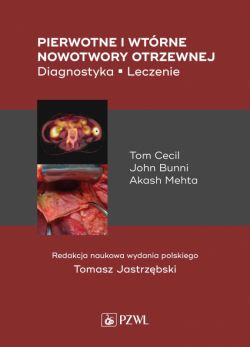 Okadka ksiki - Pierwotne i wtrne nowotwory otrzewnej. Diagnostyka. Leczenie