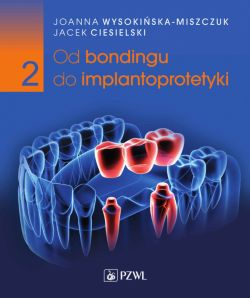 Okadka ksiki - Od bondingu do implantoprotetyki. Cz. II