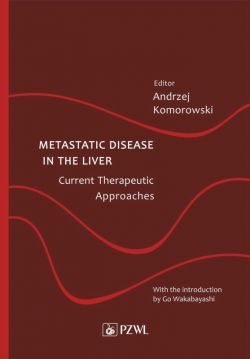 Okadka ksiki - Metastatic Disease in the Liver  Current Therapeutic Approaches